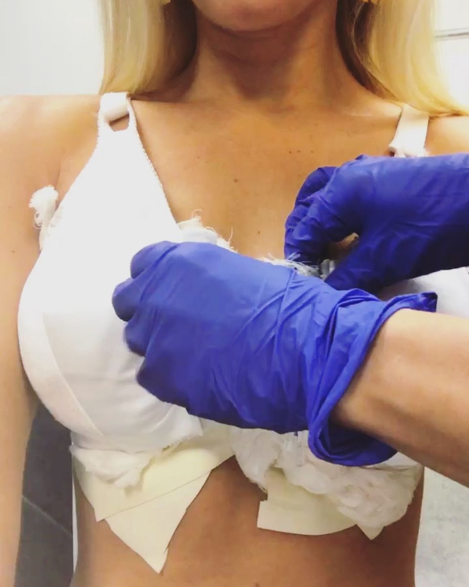 Areola tattoo treatment KM Orgatonics