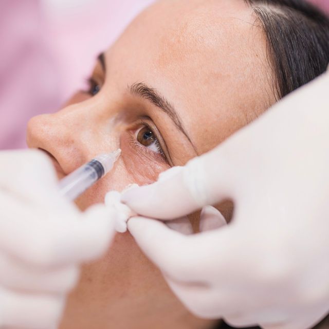 Center bottom wide image - Eyelid Augmentation results
