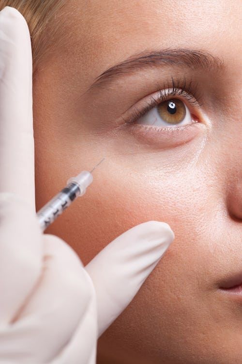 Right side vertical image - Eyelid Augmentation results