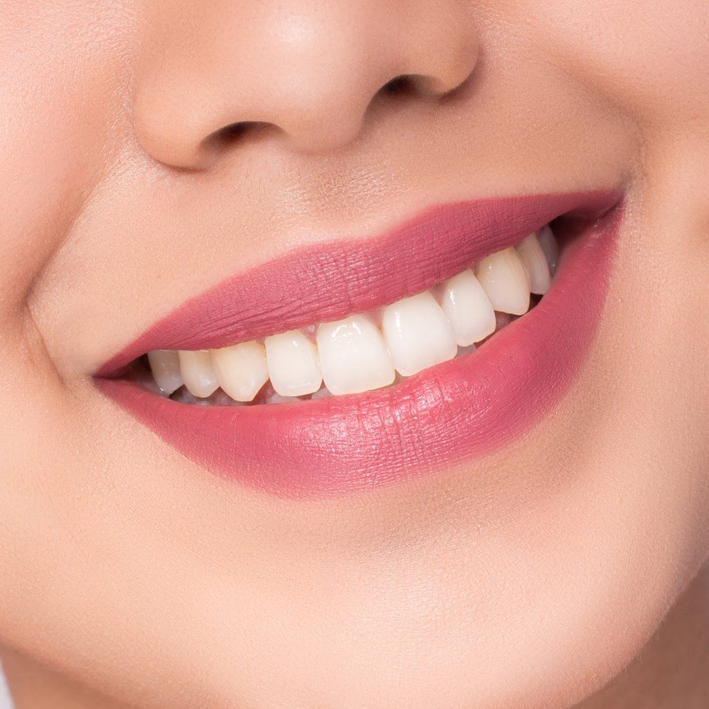 Dark Lip Correction KM Orgatonics