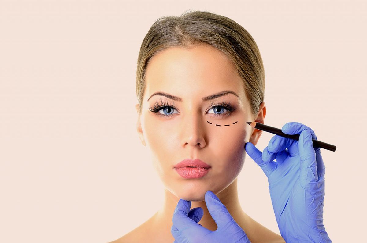 Left side vertical image - Lower Eye Lid Augmentation results