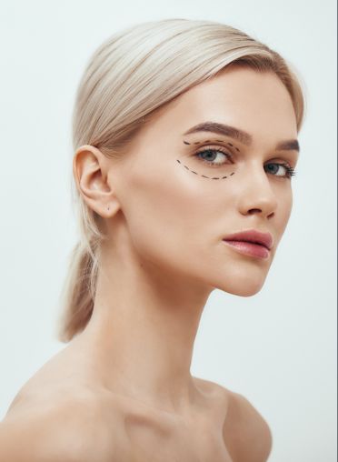 Who Can Benefit from Lower Eye Lid Augmentation