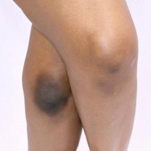 Center bottom wide image - Radiant Skin Result