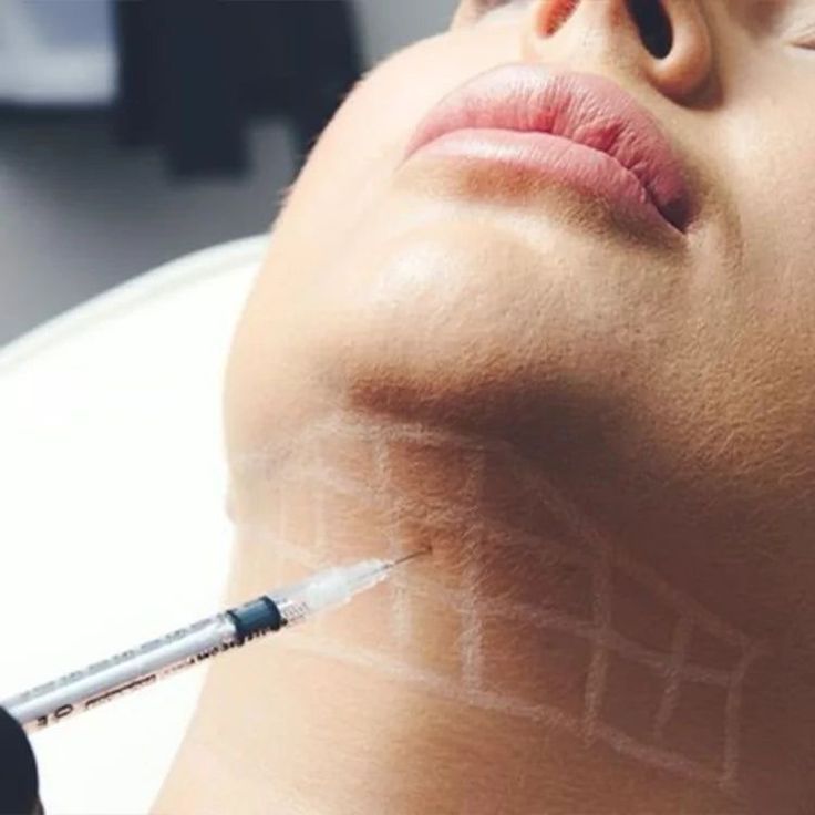 Lip Enhancement and Under-Eye Correction – Non-Surgical Derma Fillers at KM Orgatonics Gorakhpur