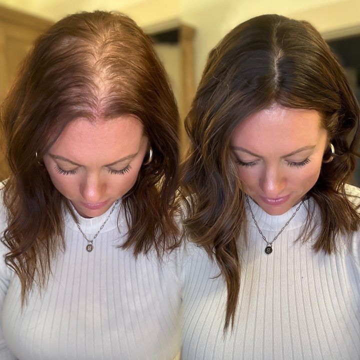 Hair Regrowth Therapy KM Orgatonics