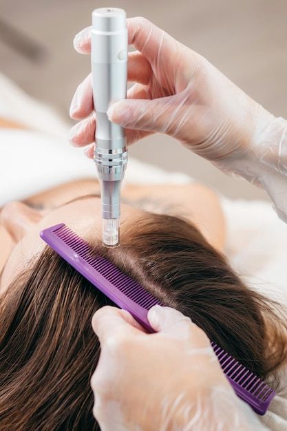 Hair Stem Cell Therapy Gorakhpur – Natural Hair Regrowth Results at KM Orgatonics