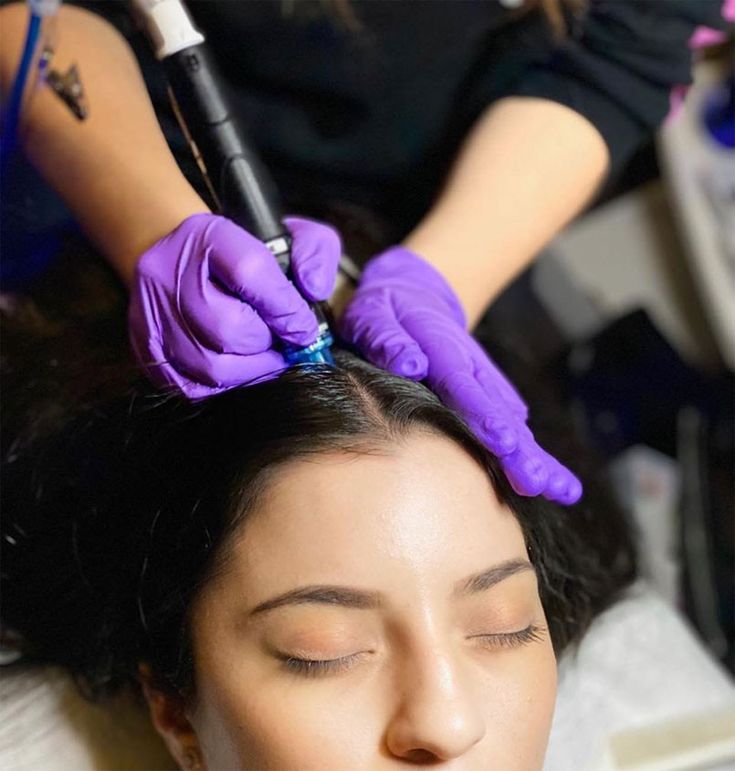 Hair Regrowth Treatment KM Orgatonics – Follicle Activation and Density Improvement