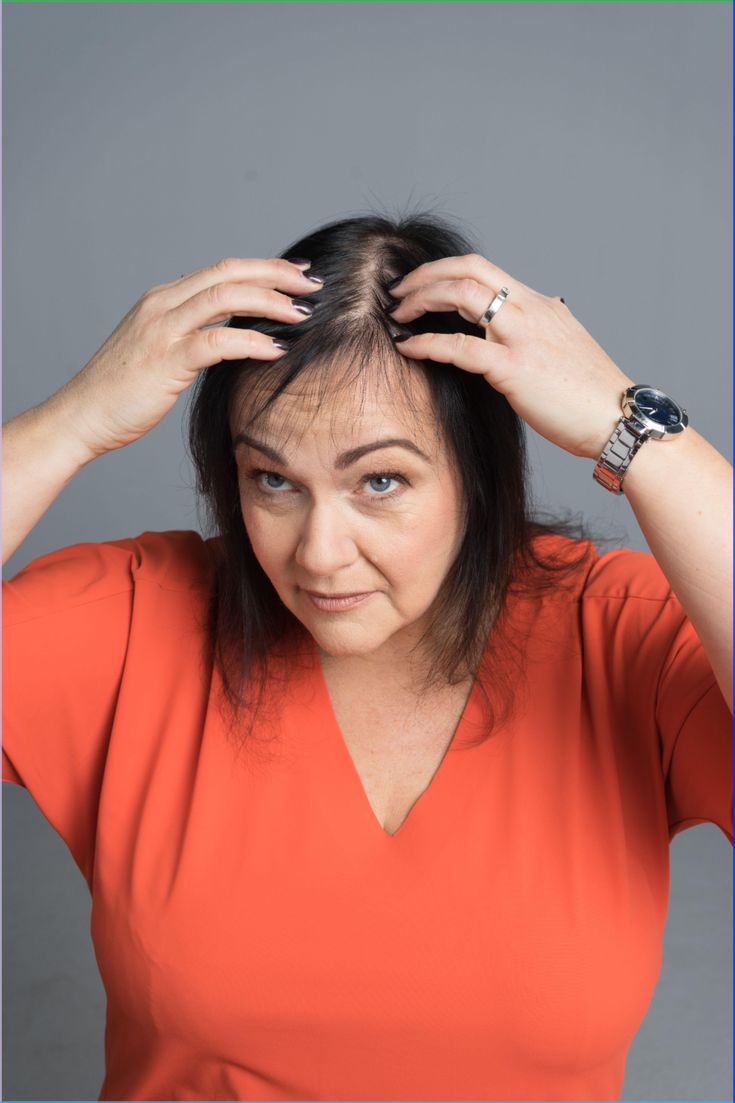 Hair Thinning Treatment – Density Boost & Strengthening Therapy at KM Orgatonics