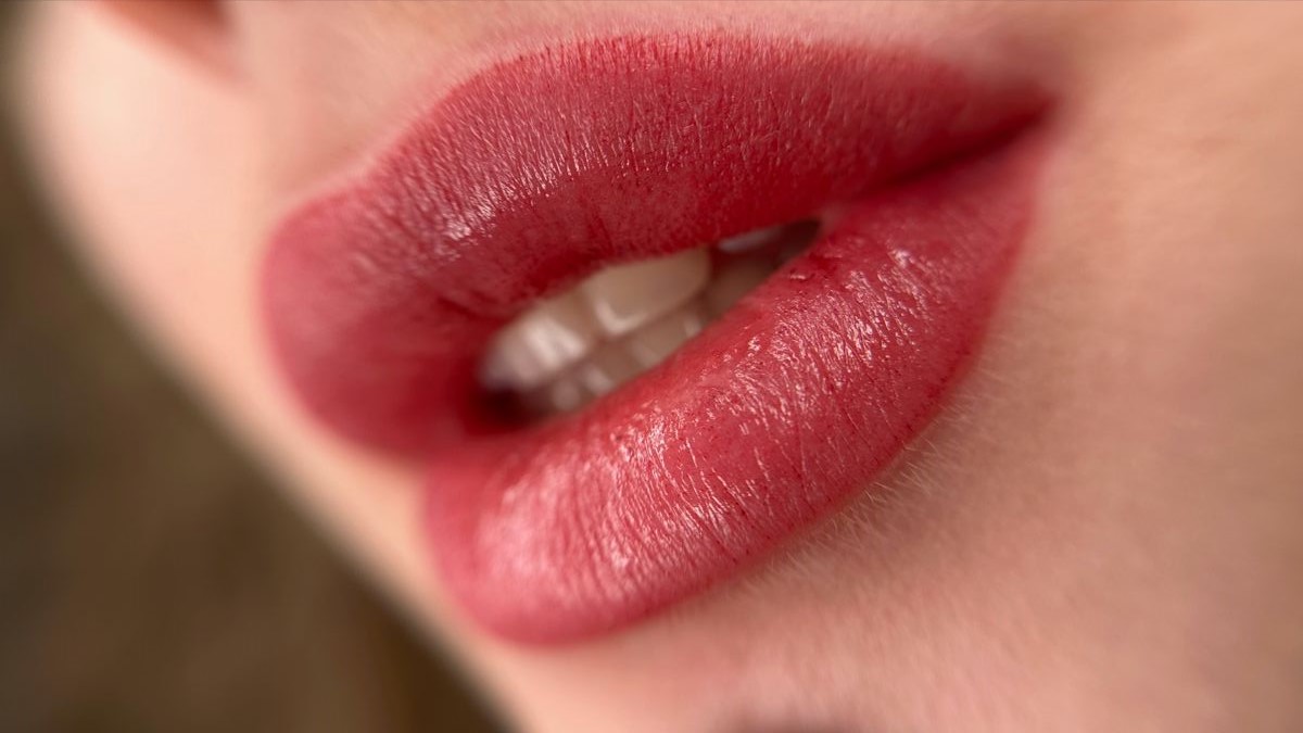 Lip Filler – Natural Volume & Definition with Clinical Precision at KM Orgatonics Gorakhpur