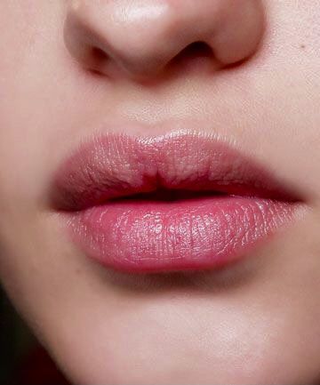 Lip Enhancement Treatment KM Orgatonics – Expert Application & Precision