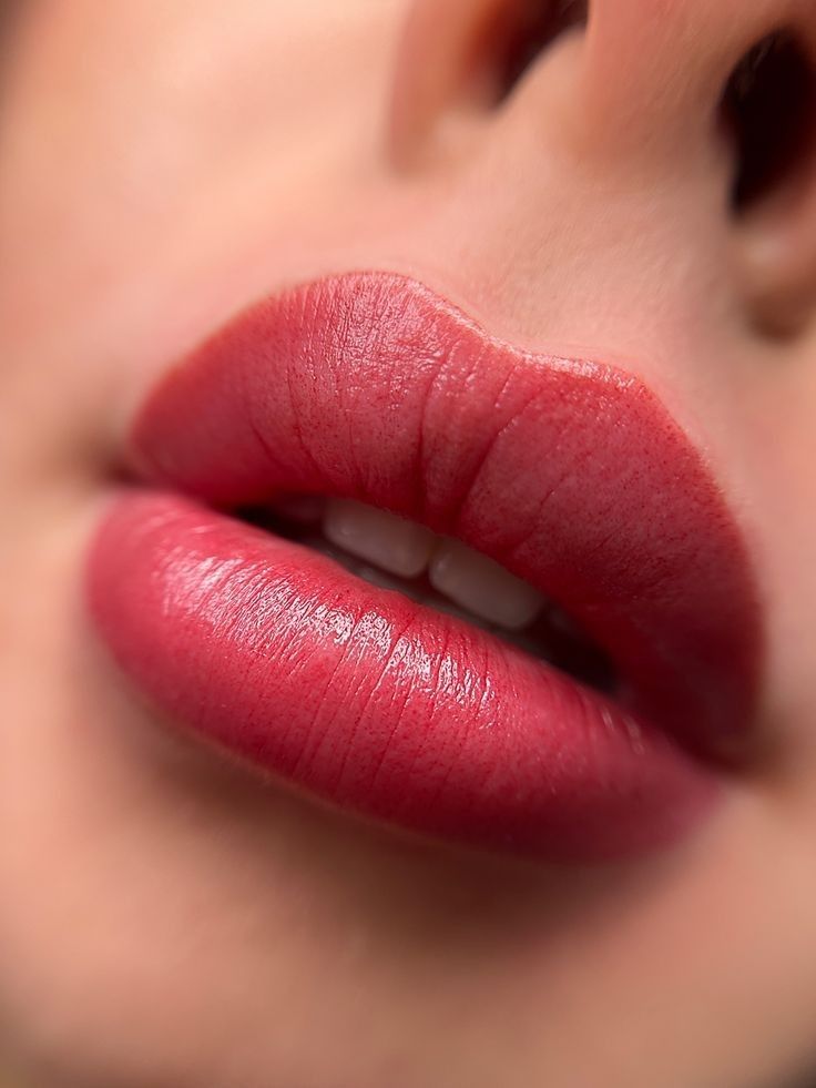 Natural Lip Fillers Gorakhpur – Before and After Subtle Transformation