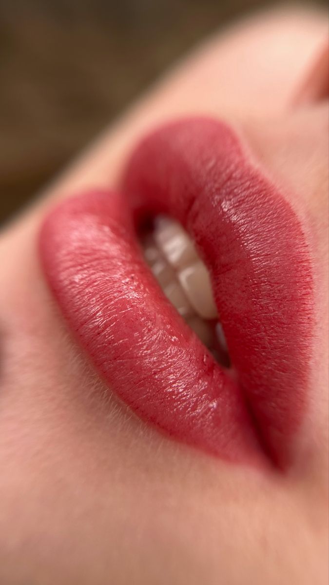 Lip Filler Treatment at KM Orgatonics Gorakhpur – Natural Volume & Definition