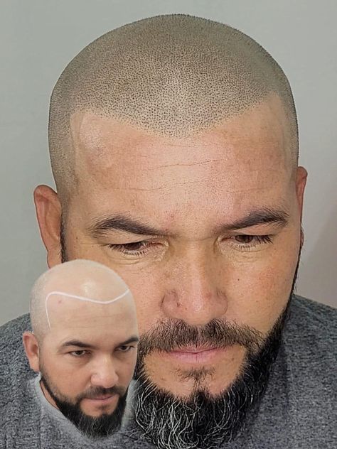 Hair Tattoo KM Orgatonics