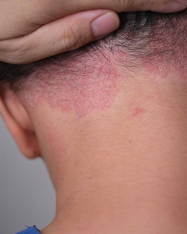 Hair Root Nourishment Gorakhpur