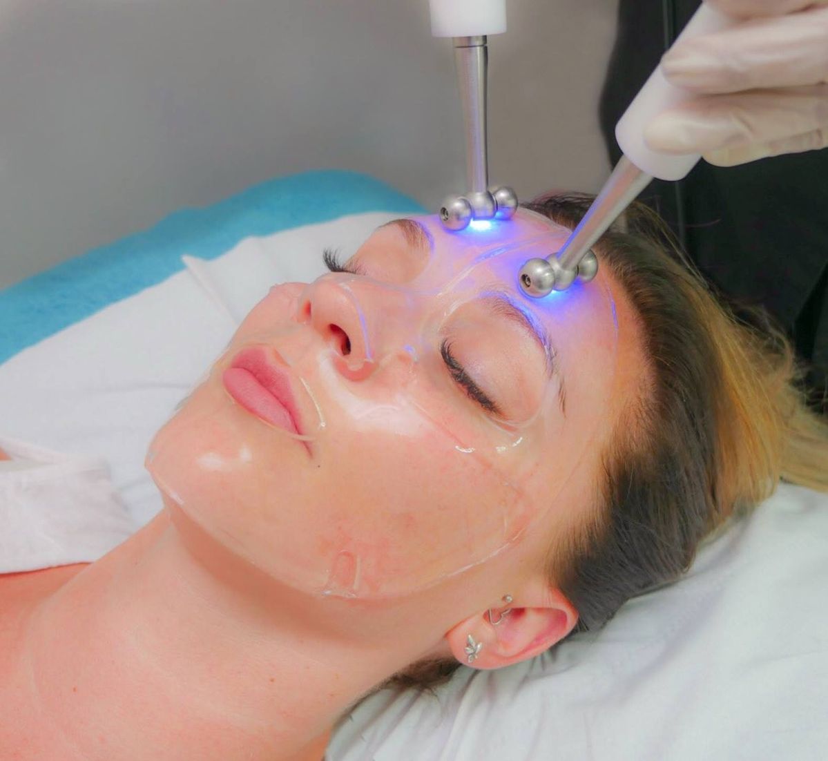 Frost Facial Therapy at KM Orgatonics