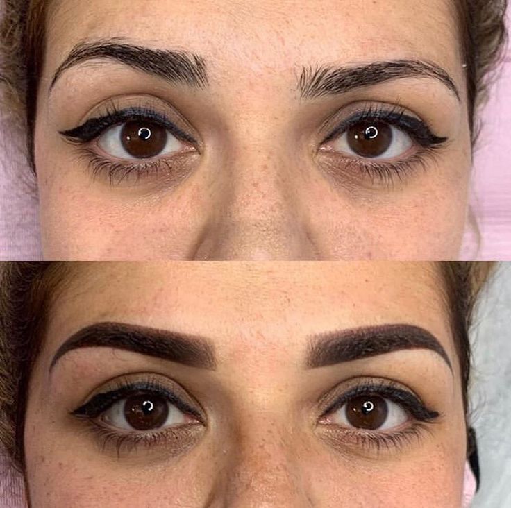 Ideal candidates for Microblading at KM Orgatonics