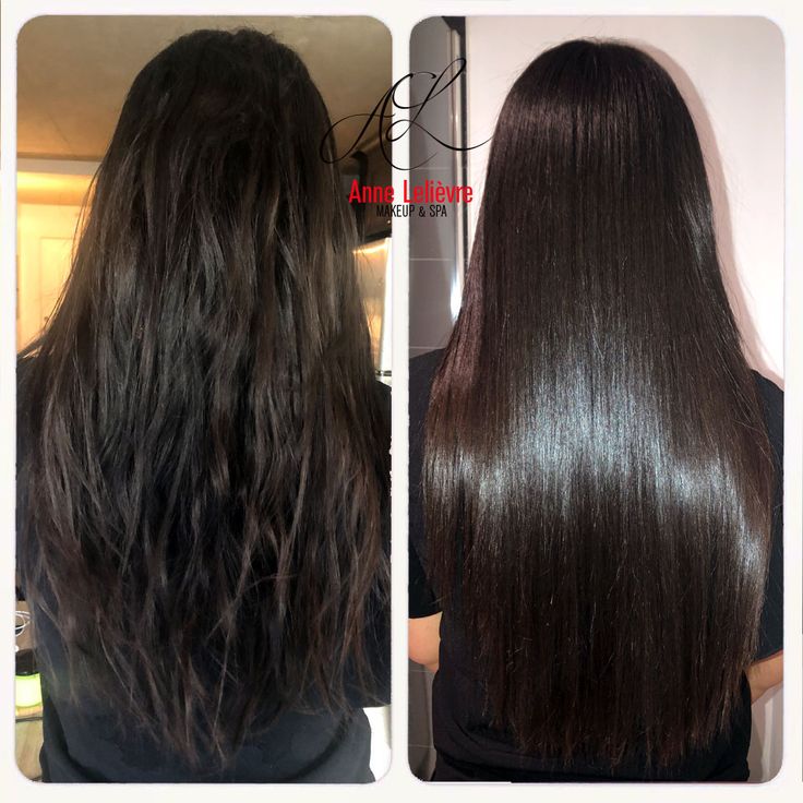 Nanoplastia Hair Transformation - Before & After 4