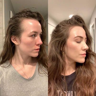 Scalp Detox Hair Transformation - Before & After 1