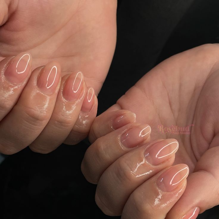 Therapeutic Gel Overlay