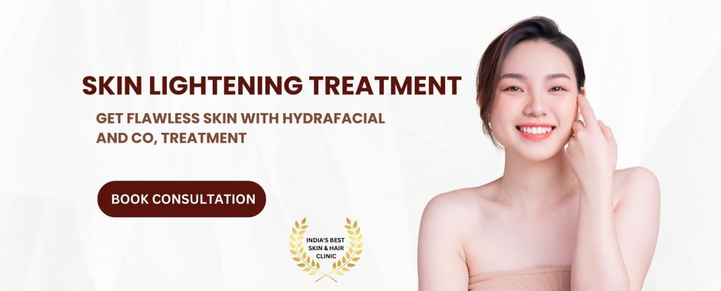 acne treatment Gorakhpur