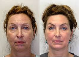 skincare consultations Gorakhpur