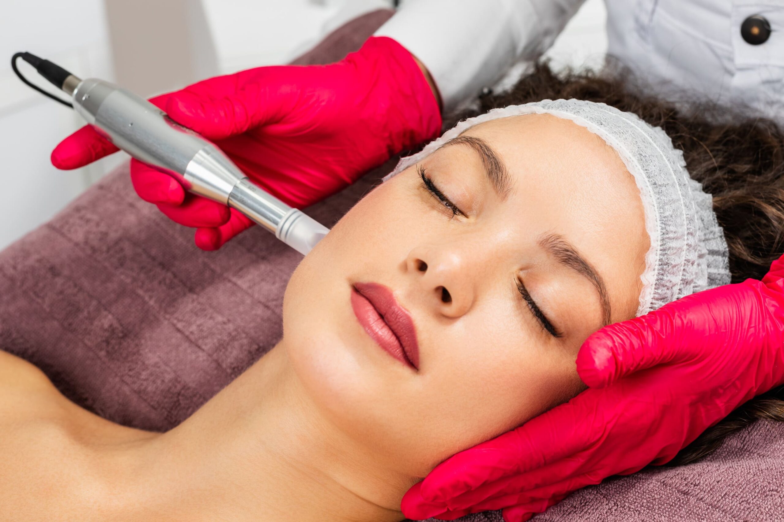Micro Needle Radio Frequency Treatment – KM Orgatonics