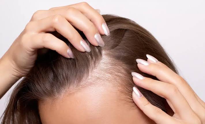 Hair Fall