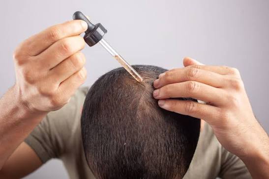 Hair Loss Treatment