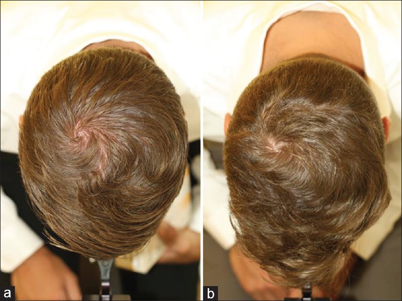 Scalp Health